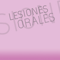 Lesiones Orales 