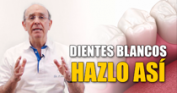 Blanqueamiento dental: siempre con supervisión profesional