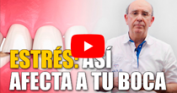Estrés: un enemigo del bienestar general y de la salud oral